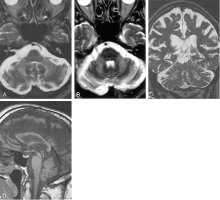 Fig 2.