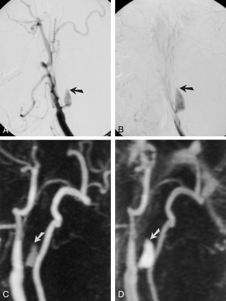 Fig 3.