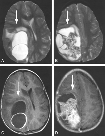 Fig 2.