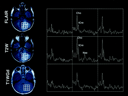 Fig 3.