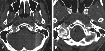 Fig 4.