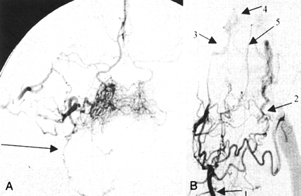 Fig 2.