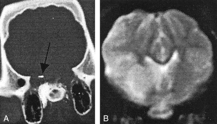 Fig 4.