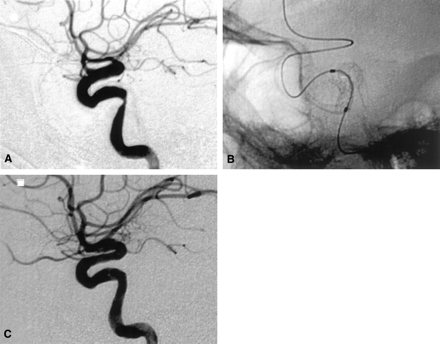 Fig 1.