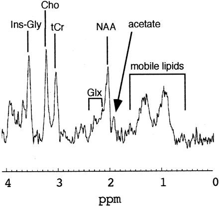 Fig 2.