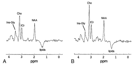 Fig 3.