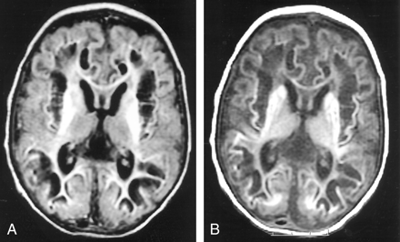 Fig 3.