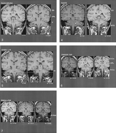 Fig 7.