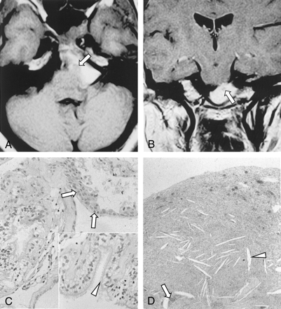 Fig 2.