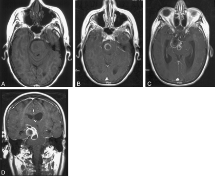 Fig 1.