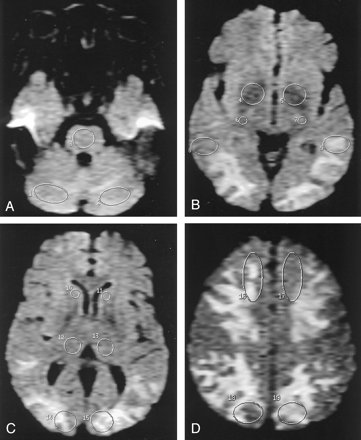 Fig 2.