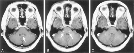 Fig 2.