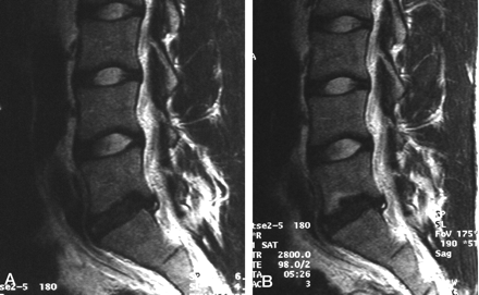 Fig 2.