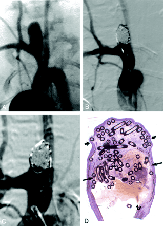 Fig 4.