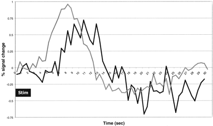 Fig 3.