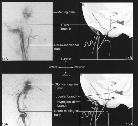 Fig 15.