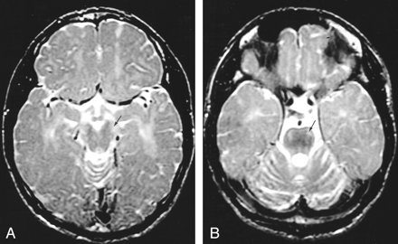 Fig 4.