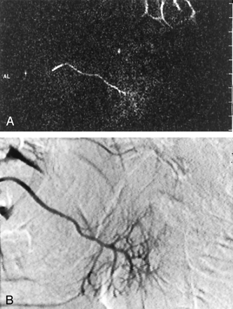 Fig 3.