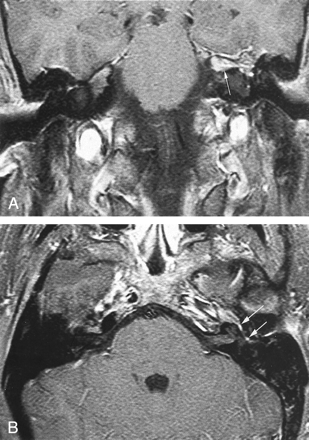 Fig 1.