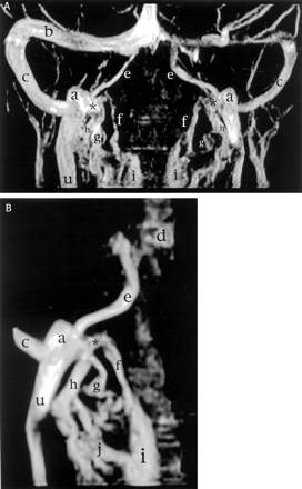 Fig 3.