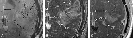 Fig 1.