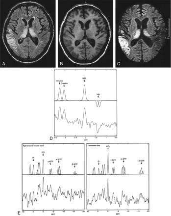 Fig 1.