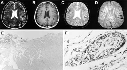 Fig 1.