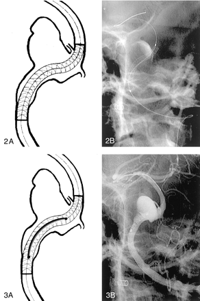 Fig 2.