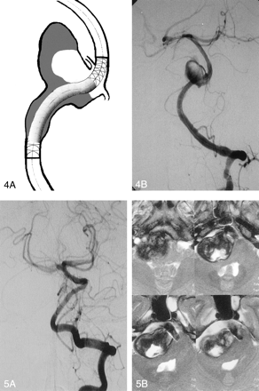 Fig 5.