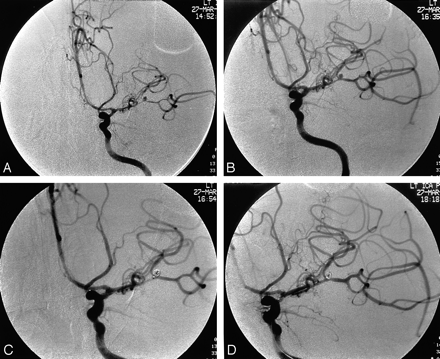 Fig 2.