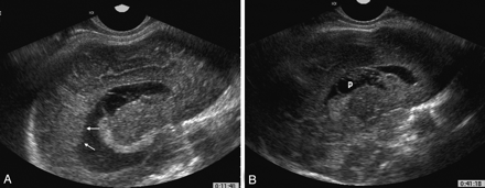 Fig 3.