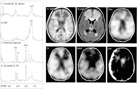 Fig 4.