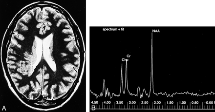 Fig 2.