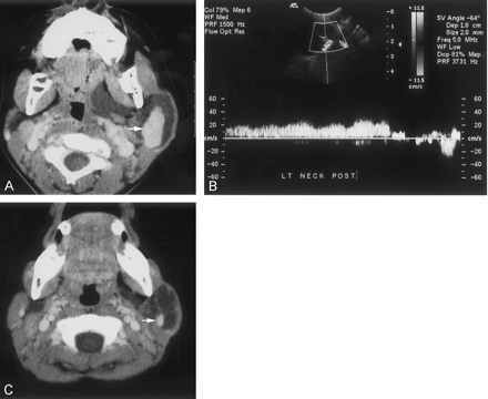 Fig 1.