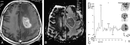 Fig 2.