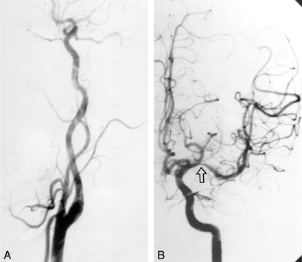 Fig 2.