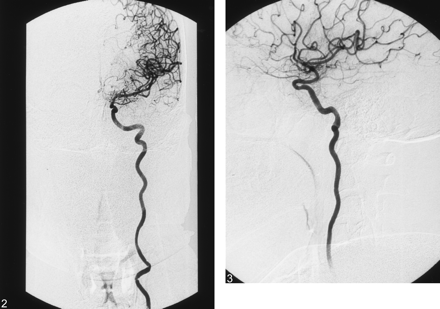 Fig 3.