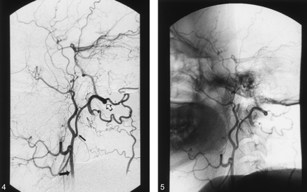 Fig 4.