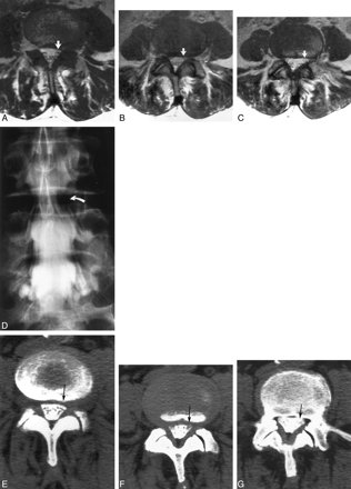 Fig 3.