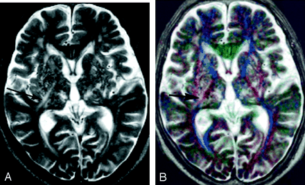 Fig 4.