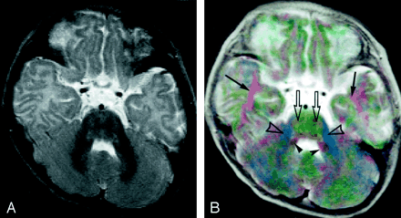 Fig 5.