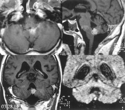 Fig 3.