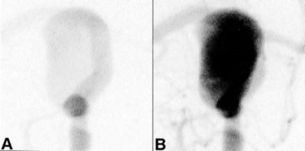 Fig 5.