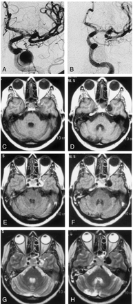 Fig 4.