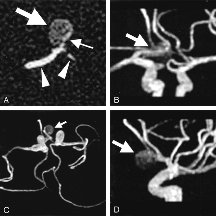 Fig 1.