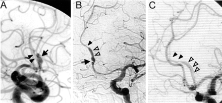 Fig 2.