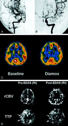 Fig 2.