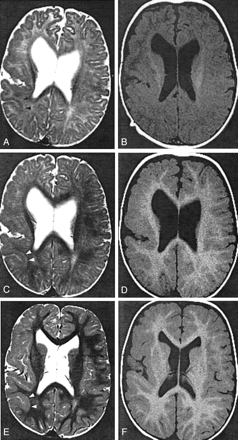 Fig 3.