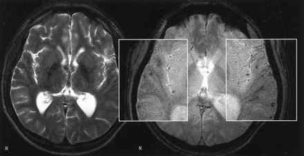 Fig 3.