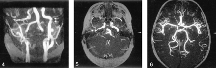 Fig 5.